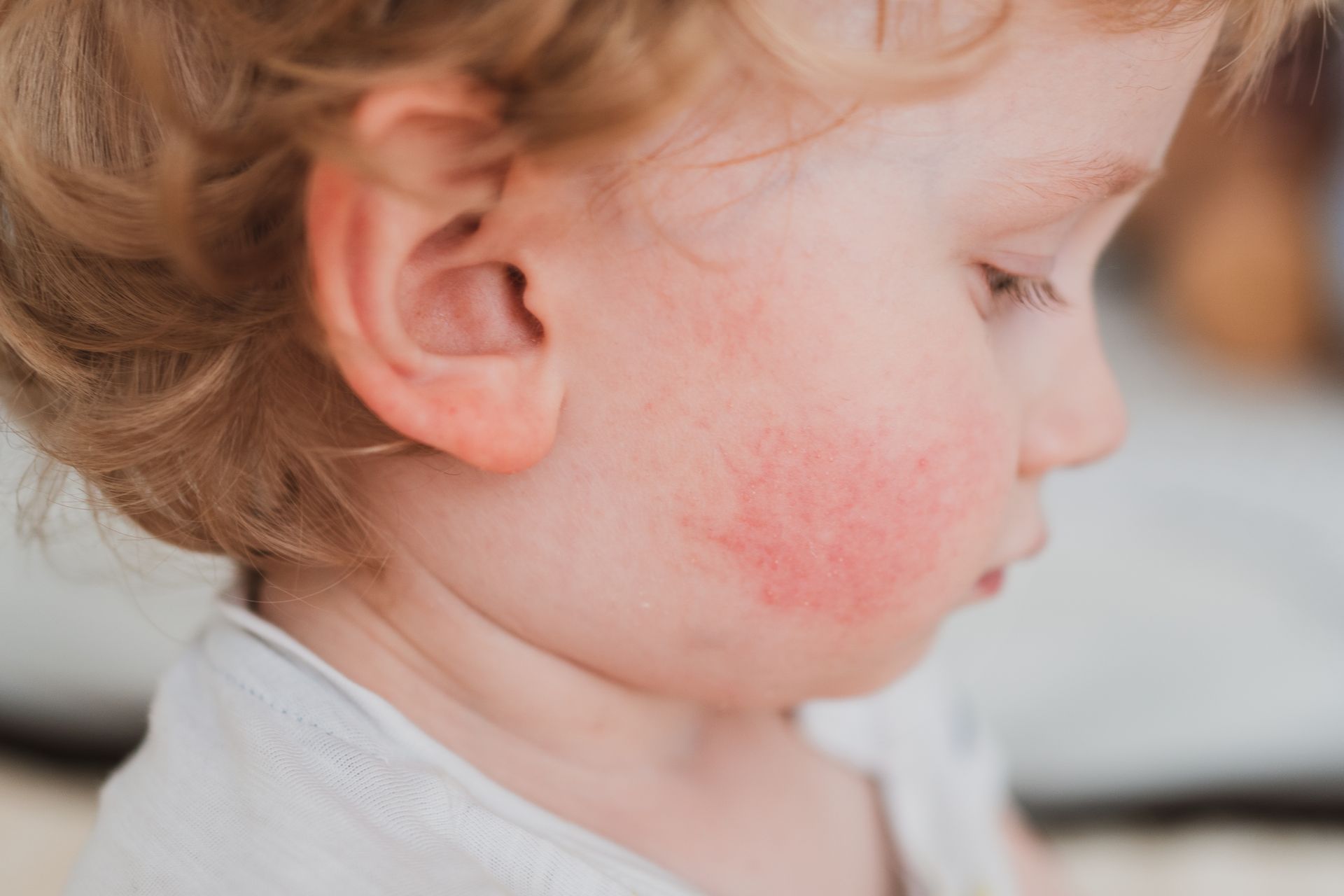 Food Allergies: What Tests Can a Food Allergy Specialist Offer?