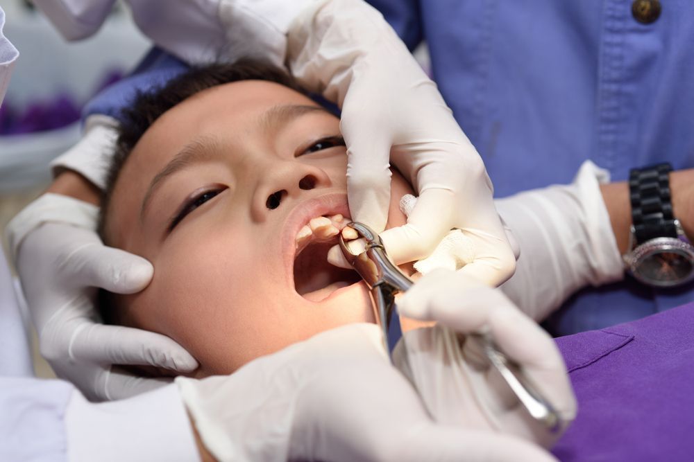 Dental procedure in progress as a patient lies back while a dentist uses tools in the mouth