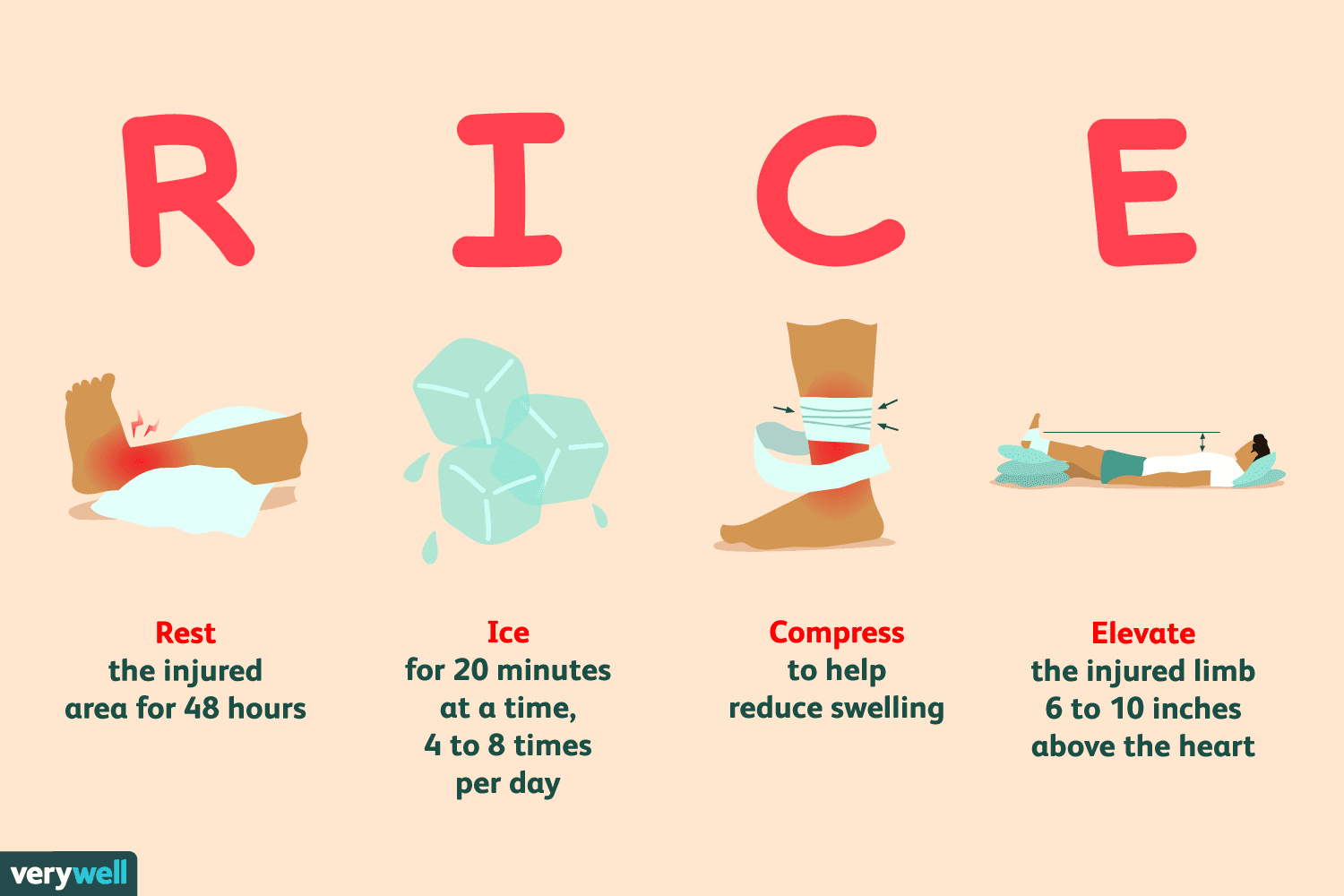 RICE method