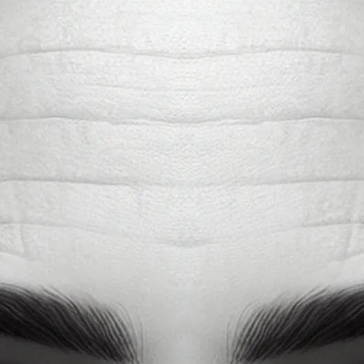 Forehead Lines close-up comparison at MAX MD in Garden City, NY