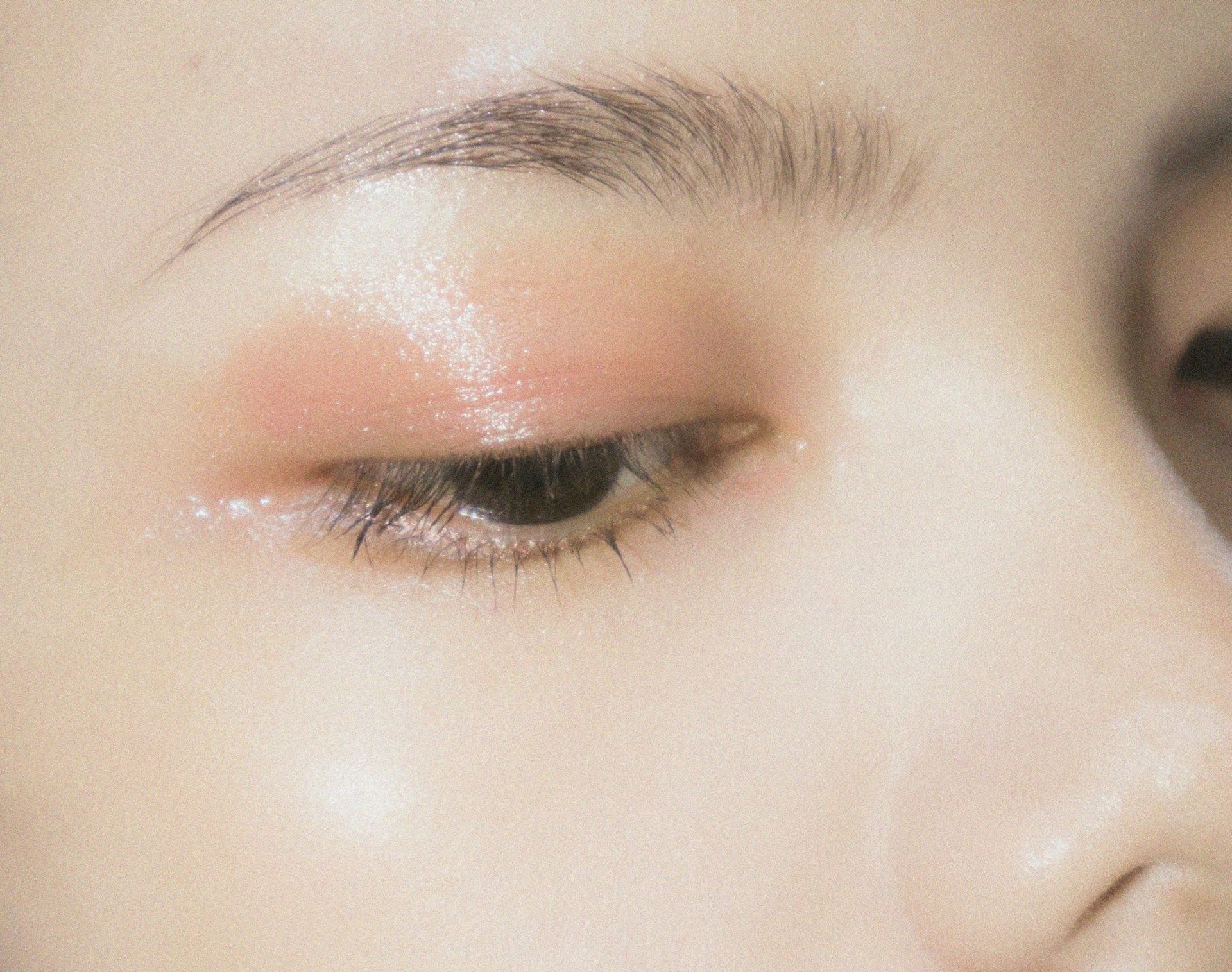 A close study of the eye area, one of the most requested areas we treat at MAX MD Medical Aesthetics and Wellness in Garden City, NY