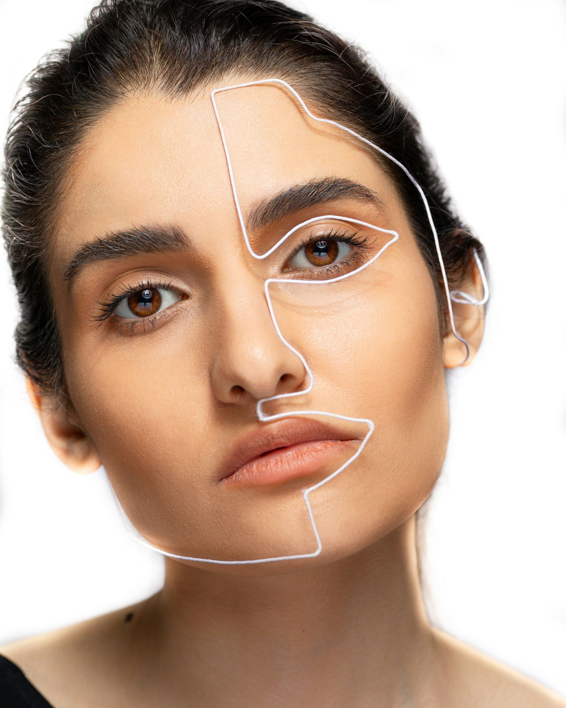 Facial proportion mapped across the profile at MAX MD Medical Aesthetics and Wellness in Garden City, NY