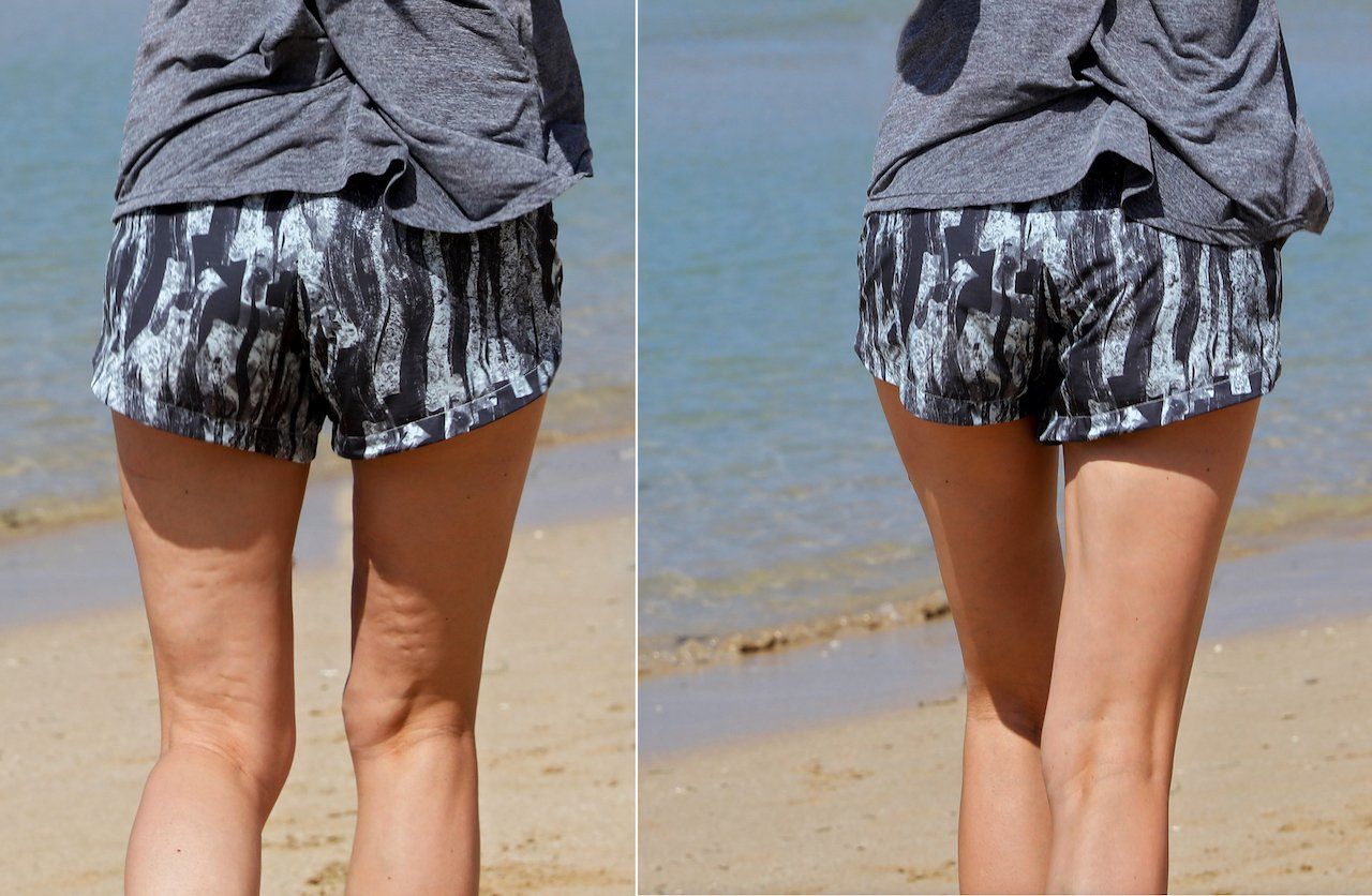 A before and after picture of a woman 's legs on the beach.