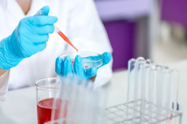 Prelievo del sangue