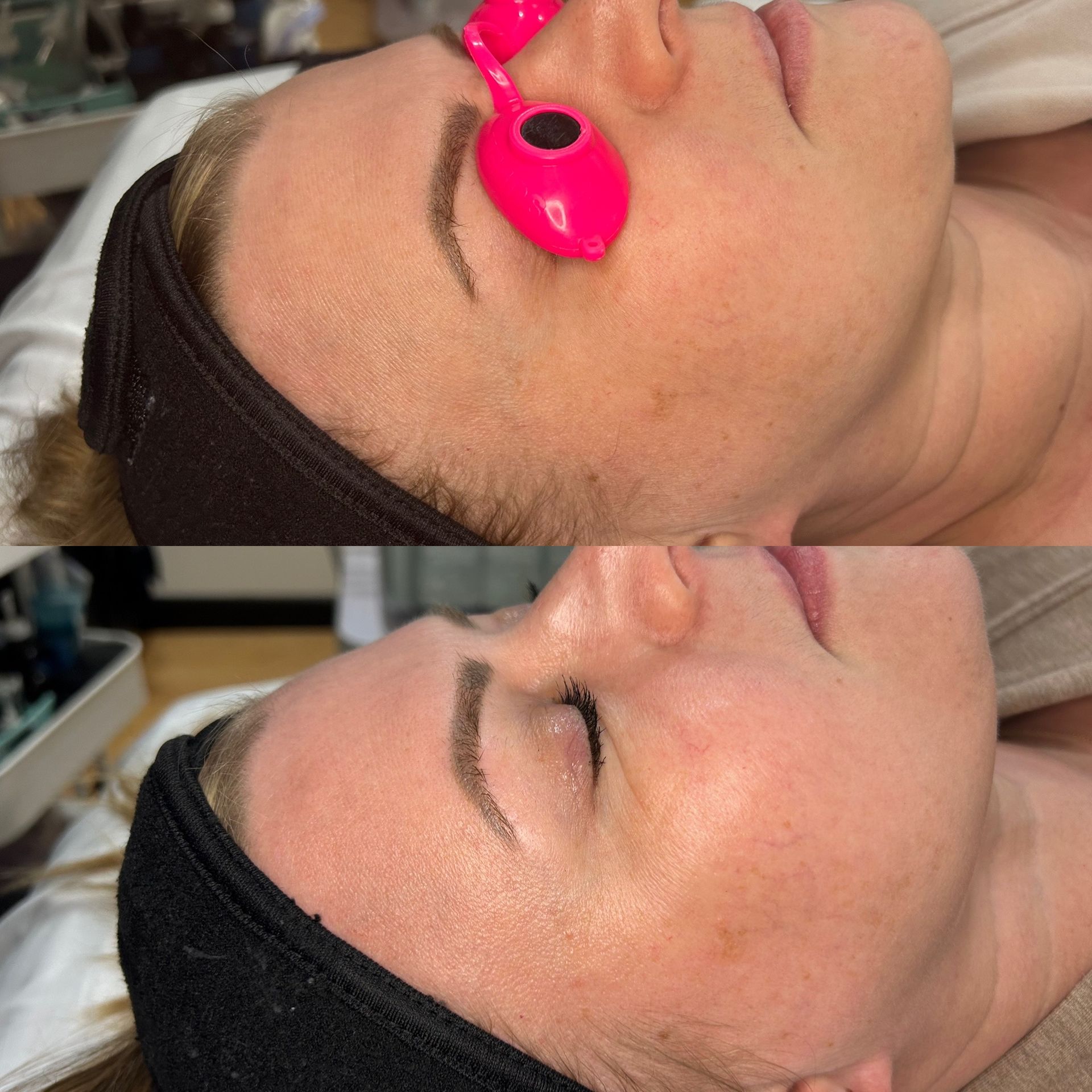 Custom facial and acne treatment room in Granger Indiana