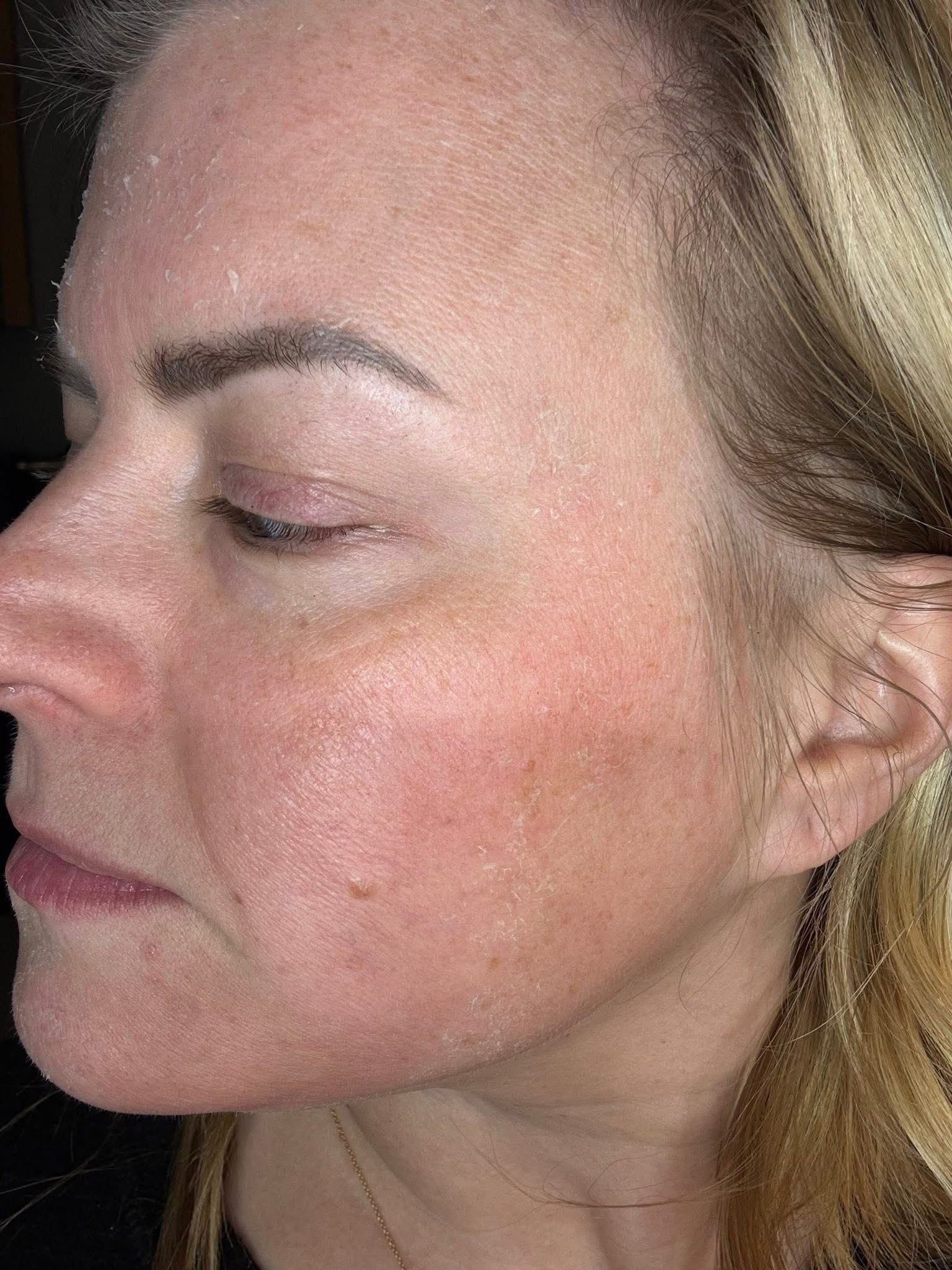 Advanced skin treatment room in Granger IN