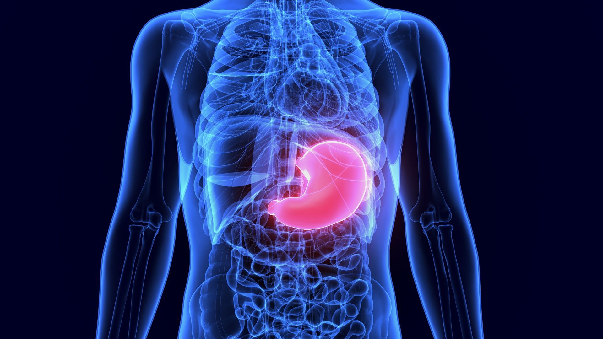 Ilustração anatômica 3D do corpo com destaque para o estômago em rosa, representando Cirurgia do Estômago
