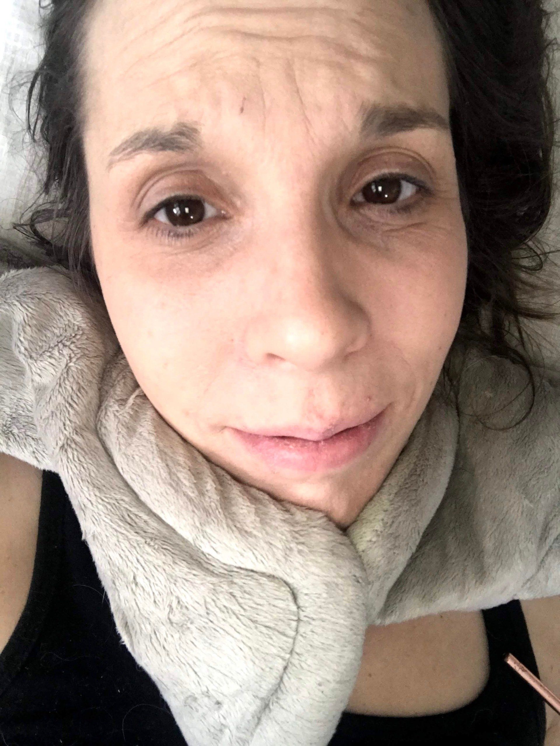 Up close of Amy's face. Looks in pain with green neck heating pad wrapped around her neck