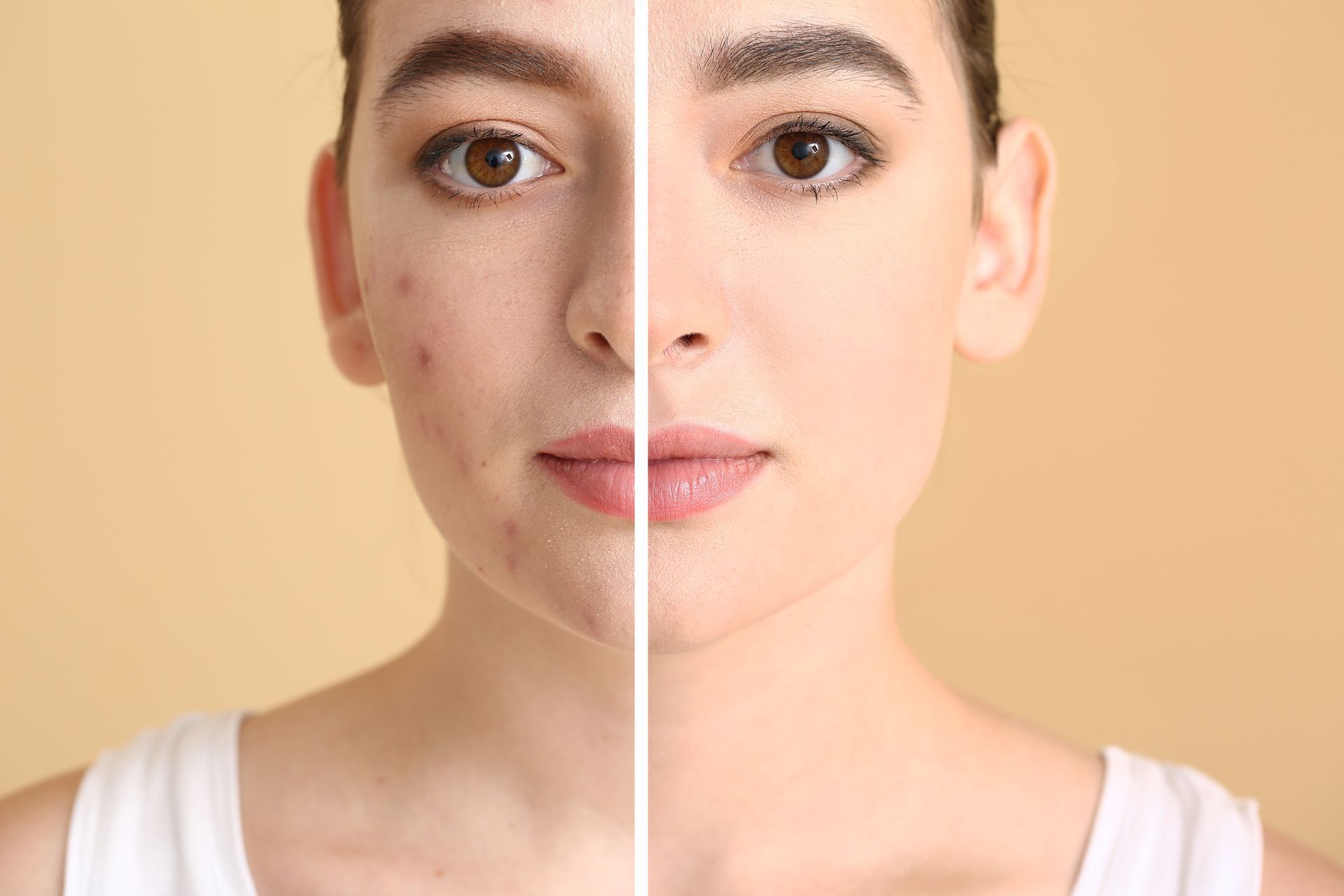 Split-face portrait showing one half with visible freckles and the other half smoother skin on a beige background