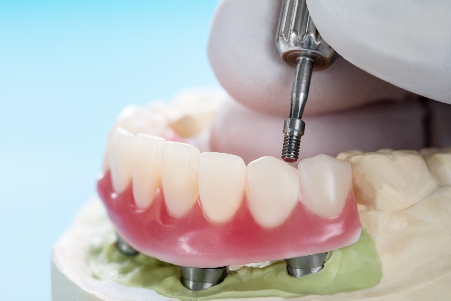 Dentist adjusting a pink-and-white dental prosthesis on a model jaw with a drill tool