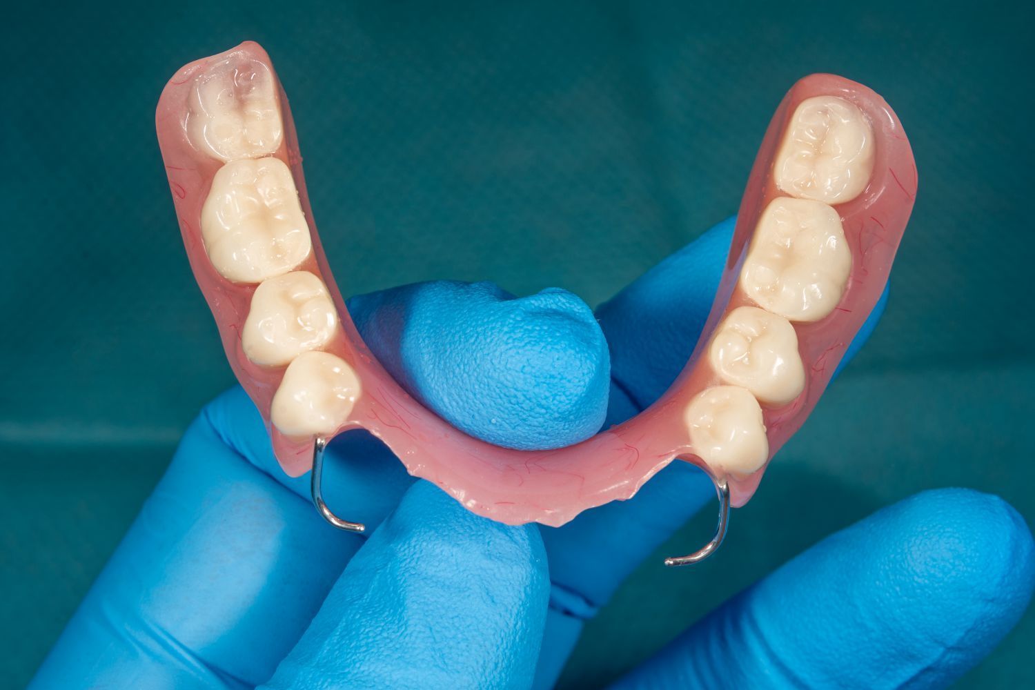 Gloved hands holding a pink dental arch model with white teeth on a teal background