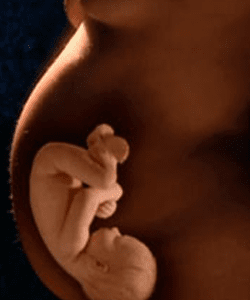 DRA. ELIZABETH DUARTE DURÁN - OBSTETRICIA DRA. ELIZABETH DUARTE DURÁN - OBSTETRICIA