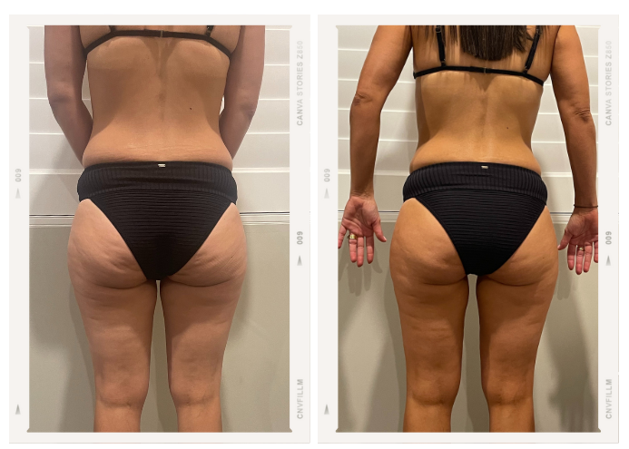 Booty and Abs Challenge Testimonial 