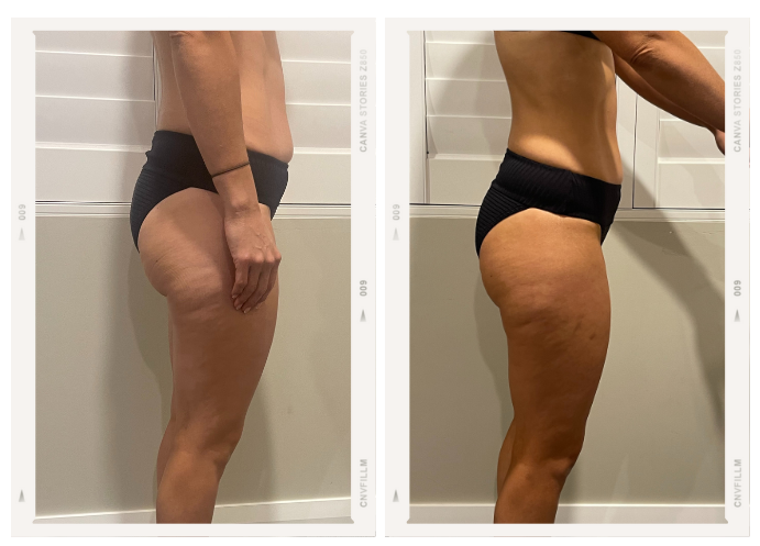 Booty and Abs Challenge Testimonial 