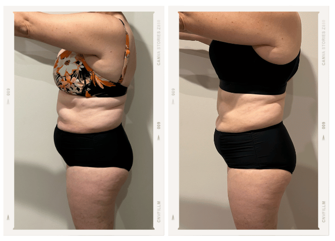 Booty and Abs Challenge Testimonial 