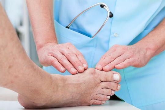 Bunion Treatments — Orland Park, IL — McDermott Podiatry Bunion Treatments — Orland Park, IL — McDermott Podiatry
