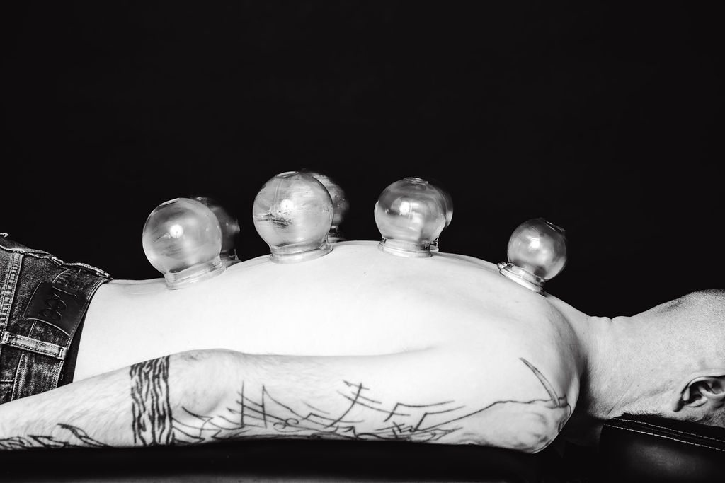 Person’s arm with four cups placed on the skin, viewed in black and white.