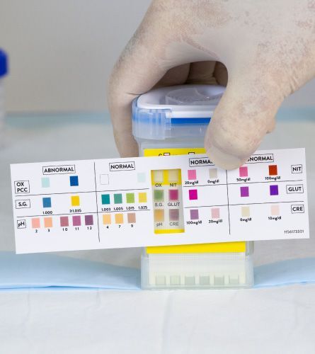 Hand holding urine test strip against a color chart for comparison — Fitzroy Fire and Safety in Kawana, QLD