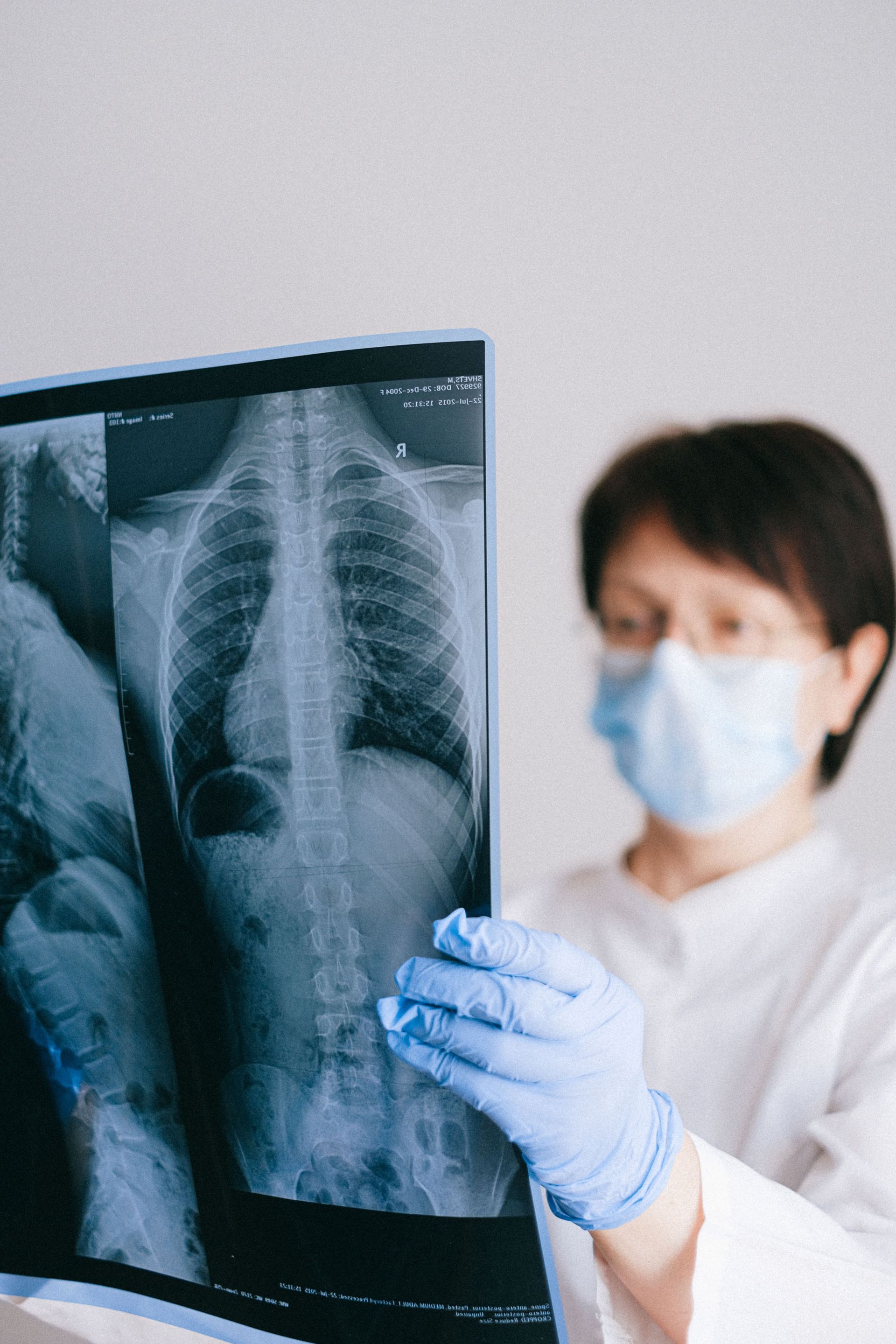 Doctor in mask and gloves examining a chest X-ray on a lightbox