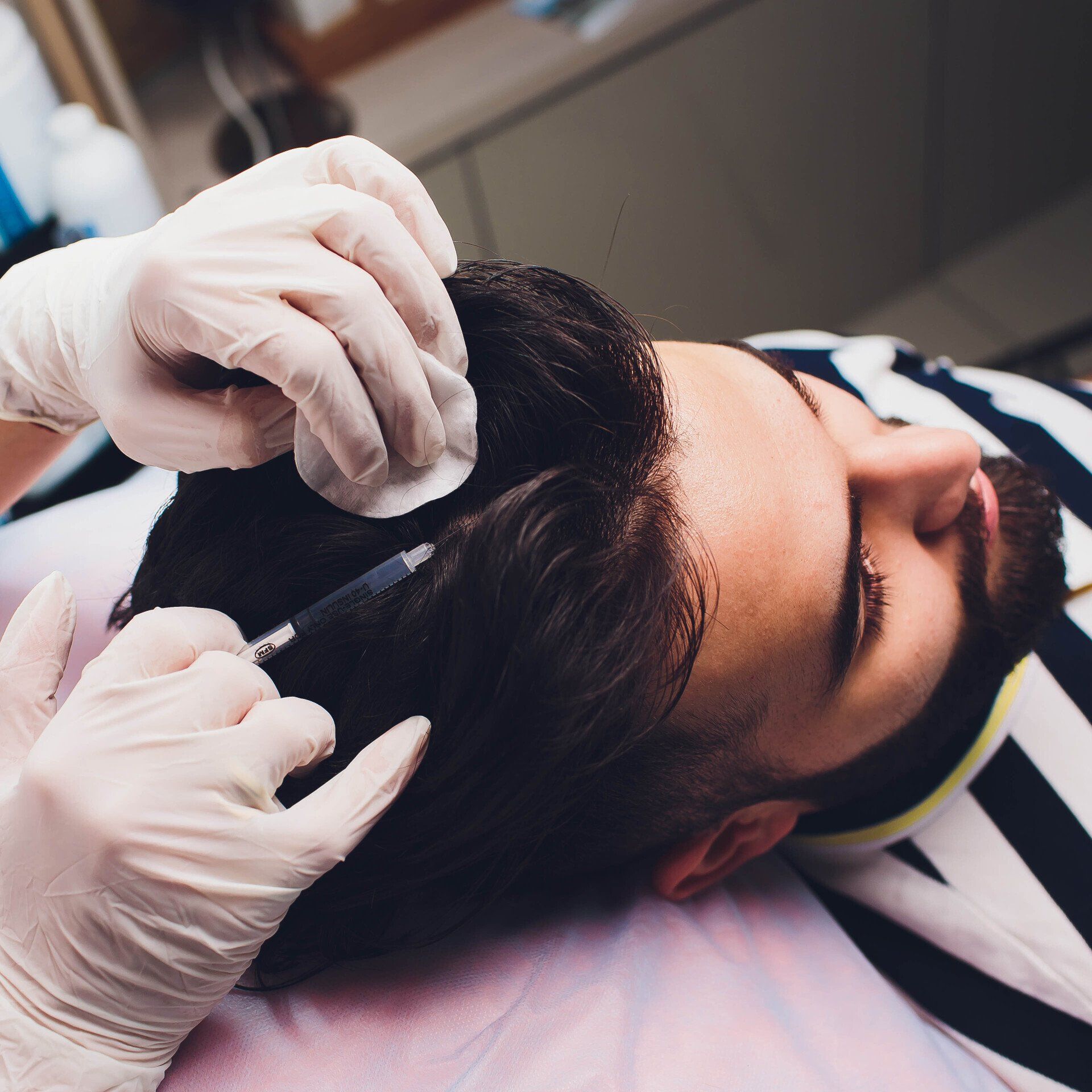  Men Hair Transplant