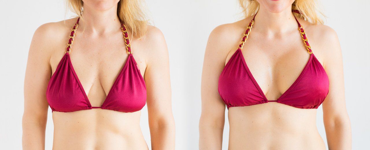 Cosmetic Surgery