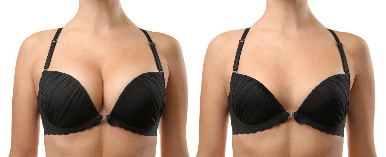 Cosmetic Surgery