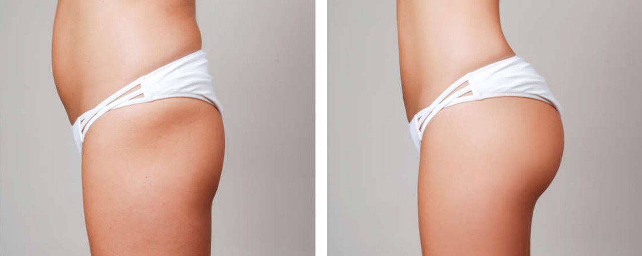 Cosmetic Surgery