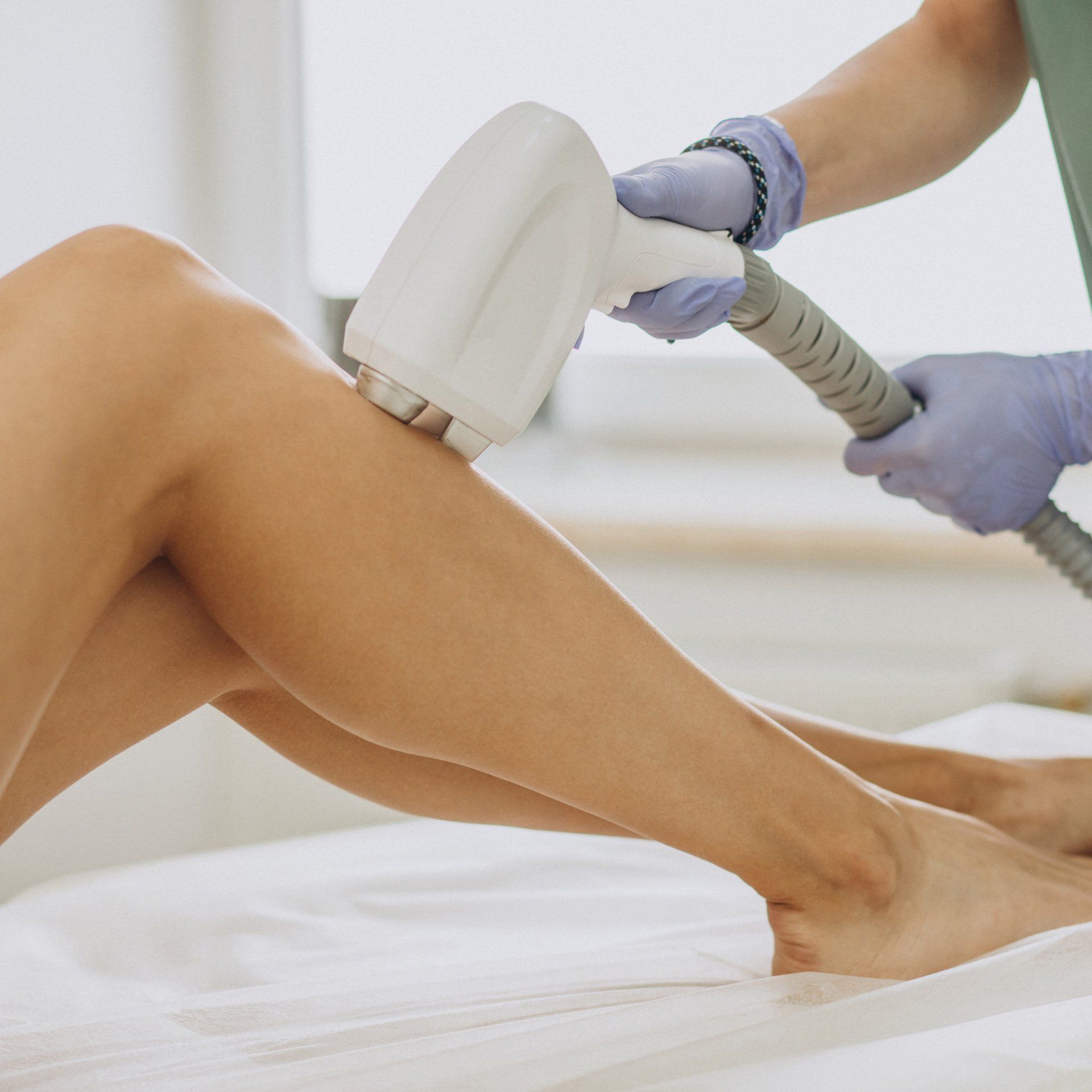 Laser Hair Removal