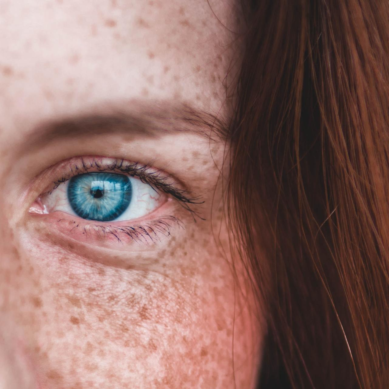 Girl With Freckles