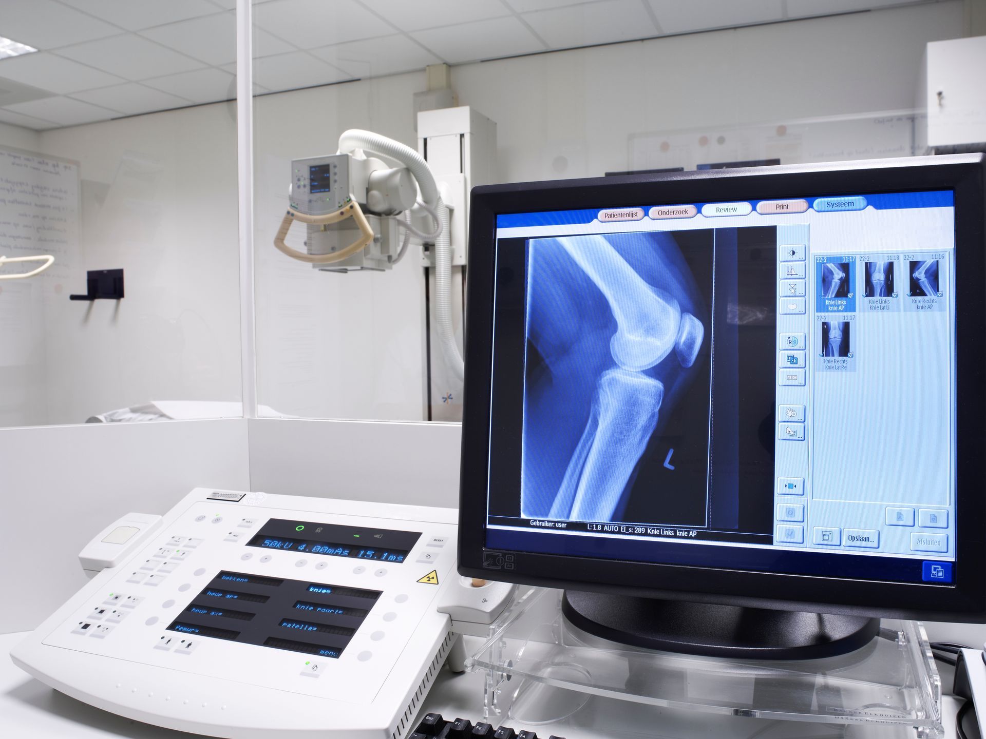 Hospital radiology room with a monitor showing an X-ray of a knee beside imaging equipment
