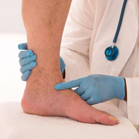 DR. ALEJANDRO GONZALEZ OCHOA - Malformaciones Vasculares