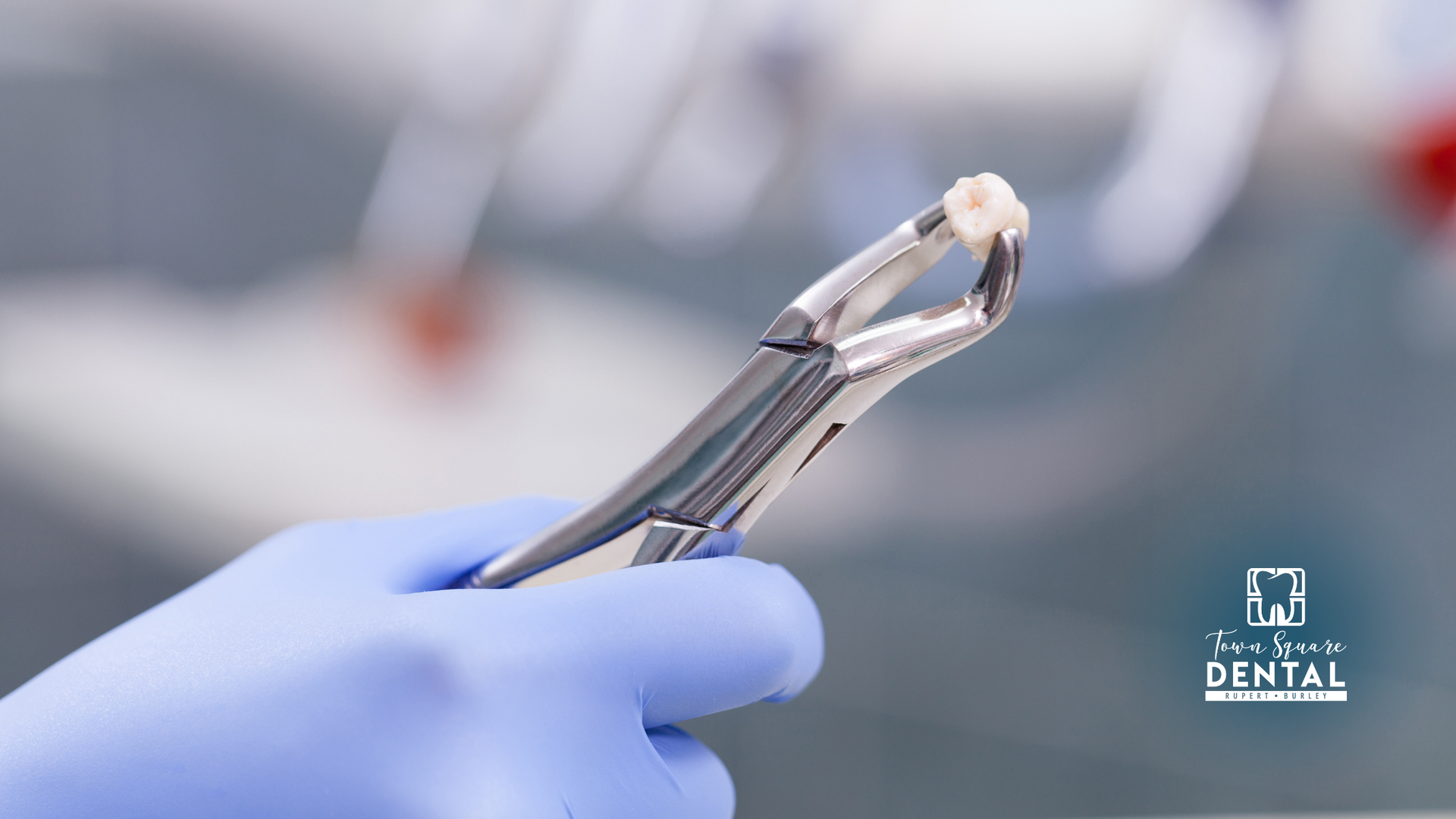 A person wearing blue gloves is holding a pair of dental pliers.