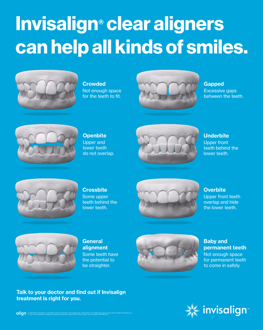 Invisalign Clear Aligners | Types Of Misalignment In Teeth | Crowded Teeth | Gapped Teeth | Openbite | Underbite | Crossbite | Overbite | General Alignment | Baby and Permanent Teeth | Town Square Dental | Best Rupert and Burley, Idaho Dentist