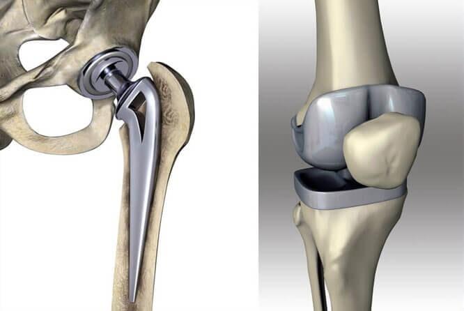 DR JUAN GILBERTO CAMPOS TOVAR - Cirugía de rodilla y artroscopia