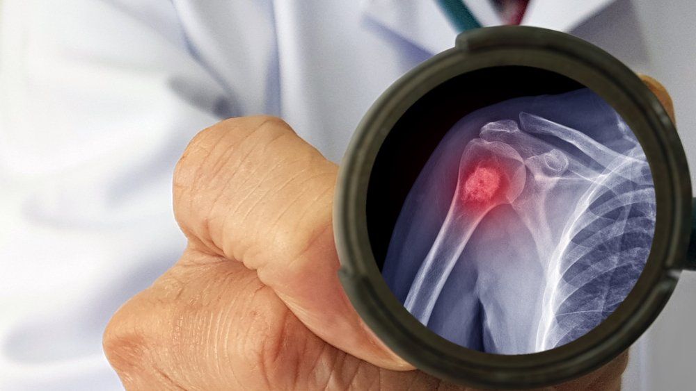 Musculoskeletal Injuries
