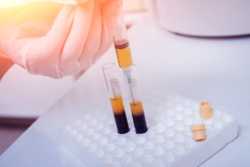 Platelet Rich Plasma treatment