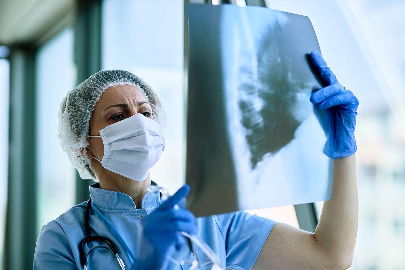 Un médico con uniforme, mascarilla y guantes examina una radiografía en un entorno médico, iluminado con luz natural.