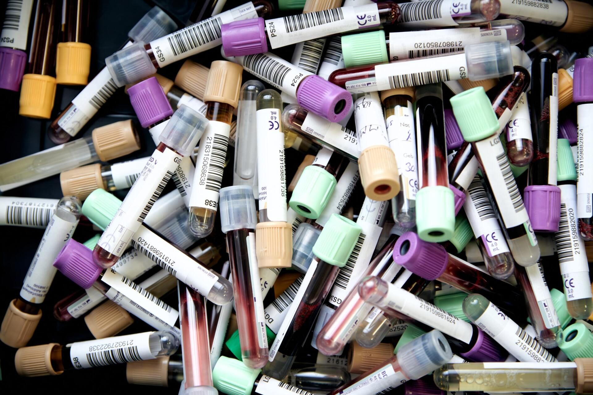 Pile of assorted capped test tubes and vials with colored labels and caps scattered together