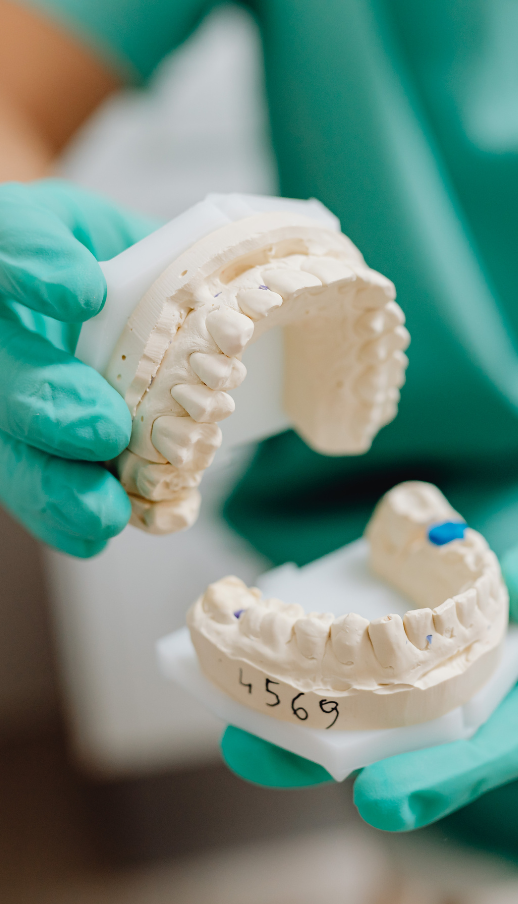 A dentist holding plaster dental molds, wearing green gloves. One mold is numbered
