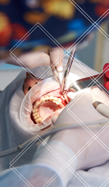A dental procedure in progress: open mouth with tools, red gloves, and surgical setting.