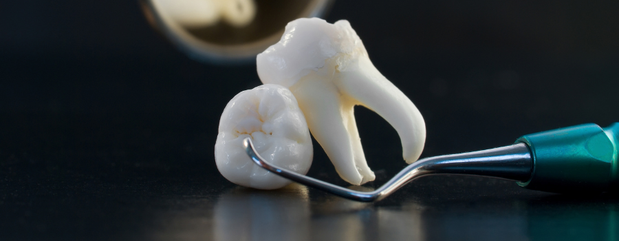 Two teeth and a dental pick on a dark surface.