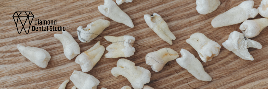 A collection of extracted human teeth on a wooden surface.