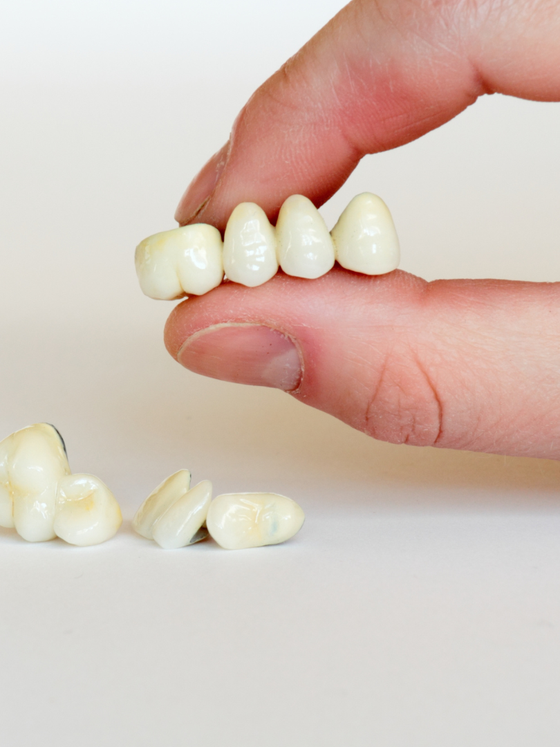 A hand holding a dental bridge, with other teeth visible below on a white surface.