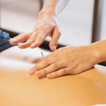 Hands performing acupuncture on a person's back with a visible needle
