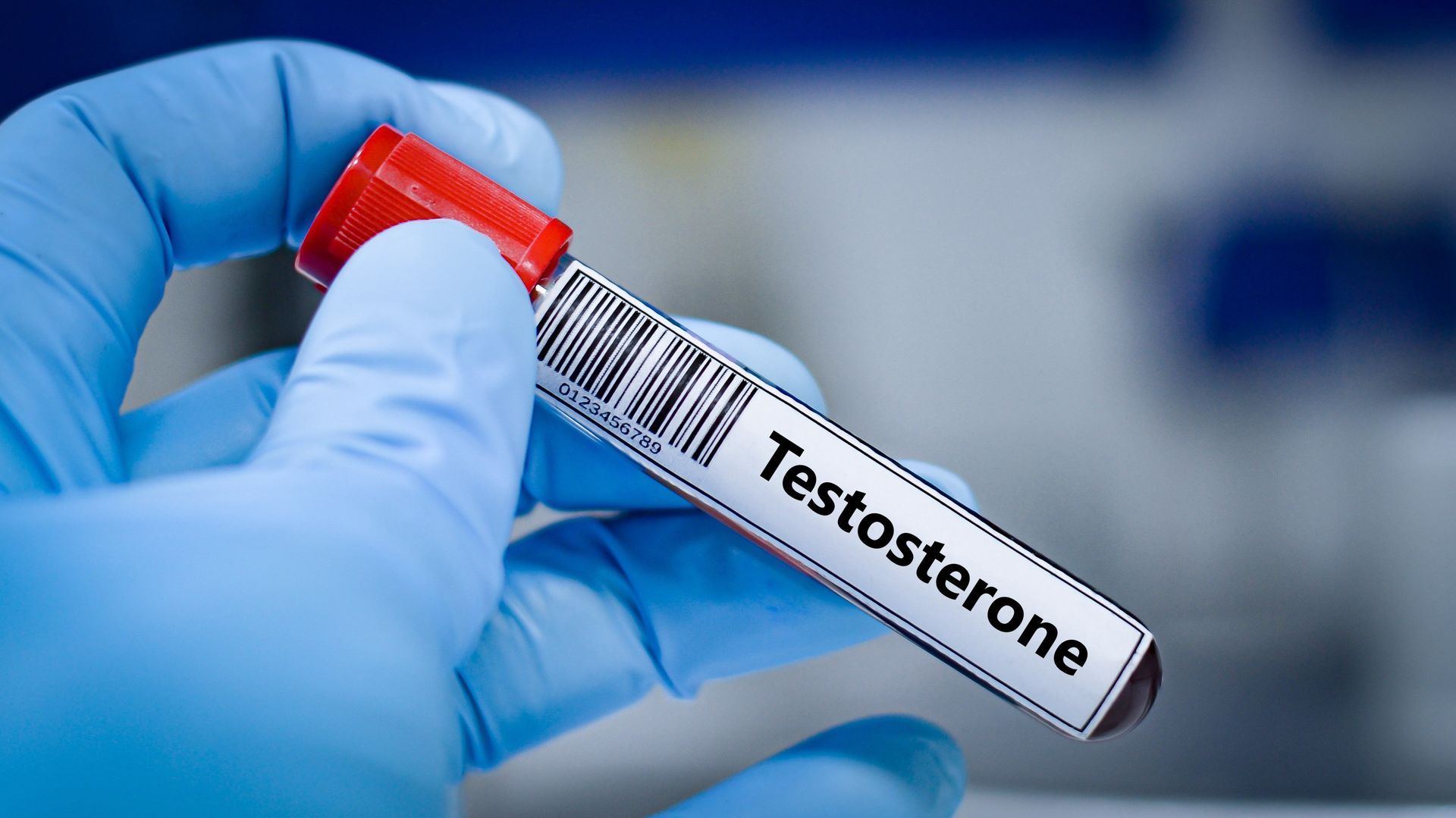 Blood sample tube for testosterone test analysis.