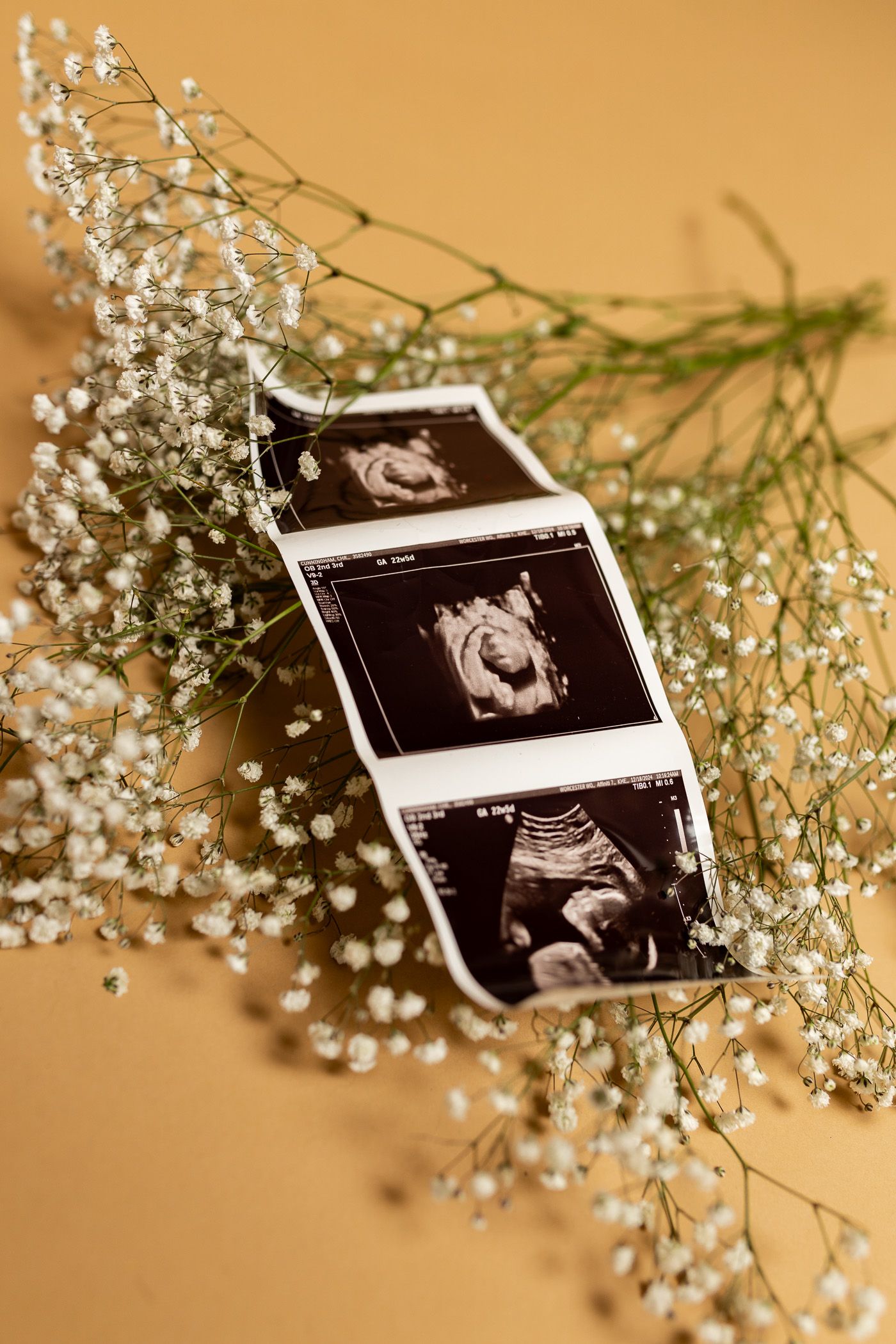 Maternity photography ultrasound photos