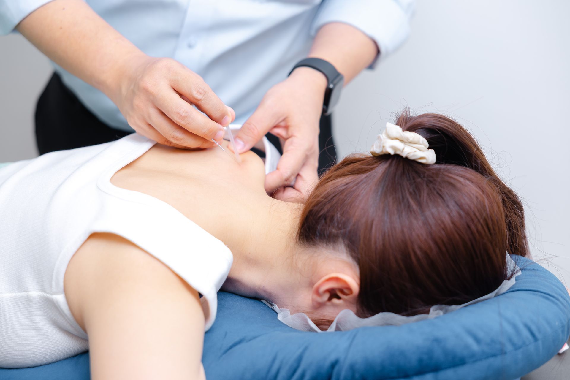 Gloved hands performing back acupuncture on a patient lying face down