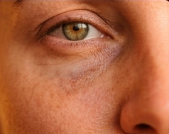 Close-up do olho e nariz de uma pessoa em pele de tom quente.