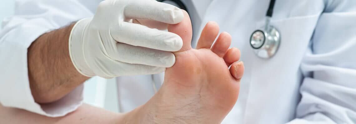Doctor examining a patient’s foot with a gloved hand and cotton swab