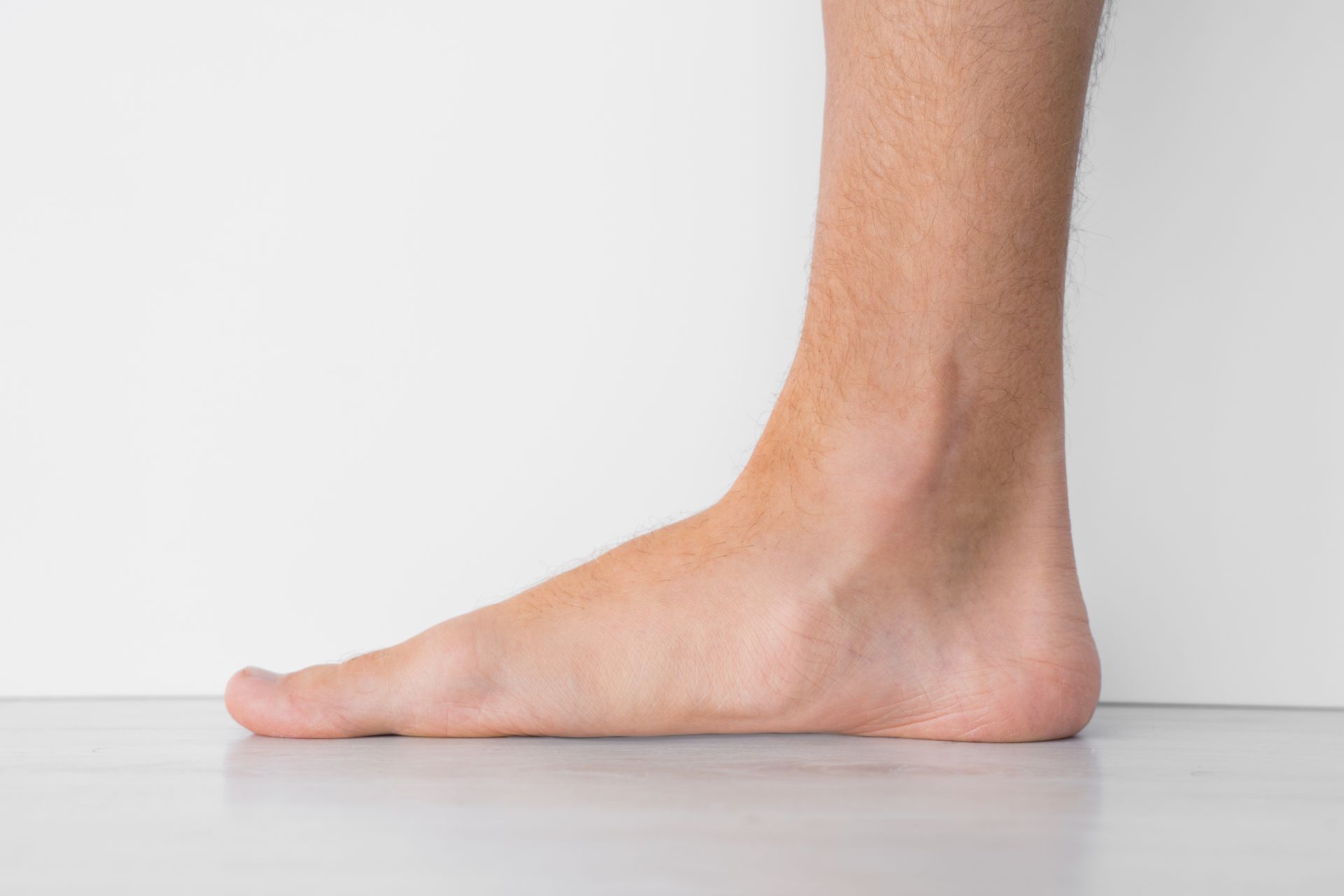 Flat Feet 